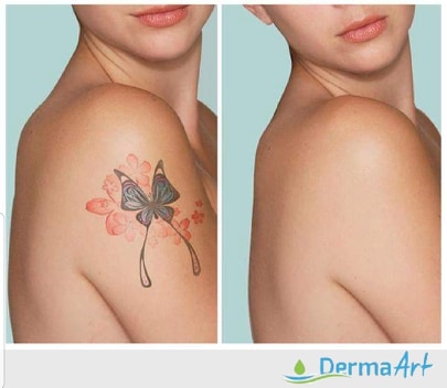 Dermatolog ne Prishtine